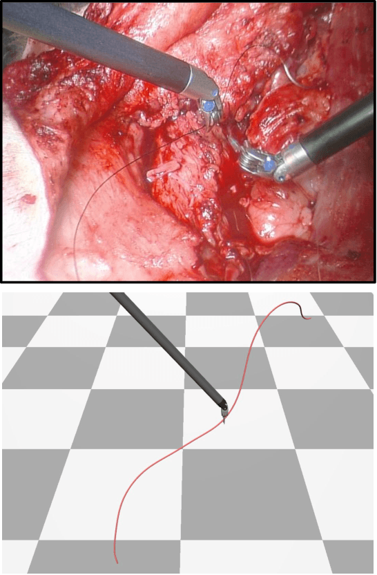 Figure 1 for Suture Thread Spline Reconstruction from Endoscopic Images for Robotic Surgery with Reliability-driven Keypoint Detection