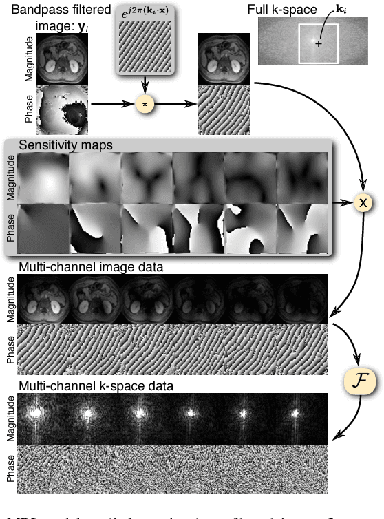 Figure 3 for Highly Scalable Image Reconstruction using Deep Neural Networks with Bandpass Filtering
