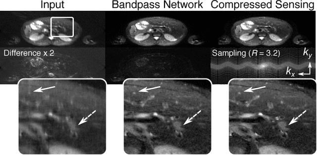 Figure 2 for Highly Scalable Image Reconstruction using Deep Neural Networks with Bandpass Filtering
