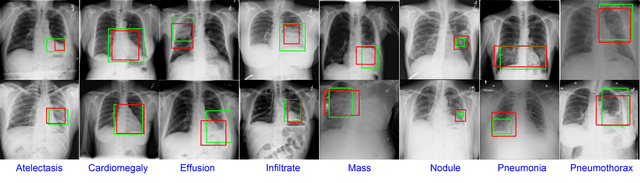 Figure 1 for A Weakly Supervised Adaptive DenseNet for Classifying Thoracic Diseases and Identifying Abnormalities