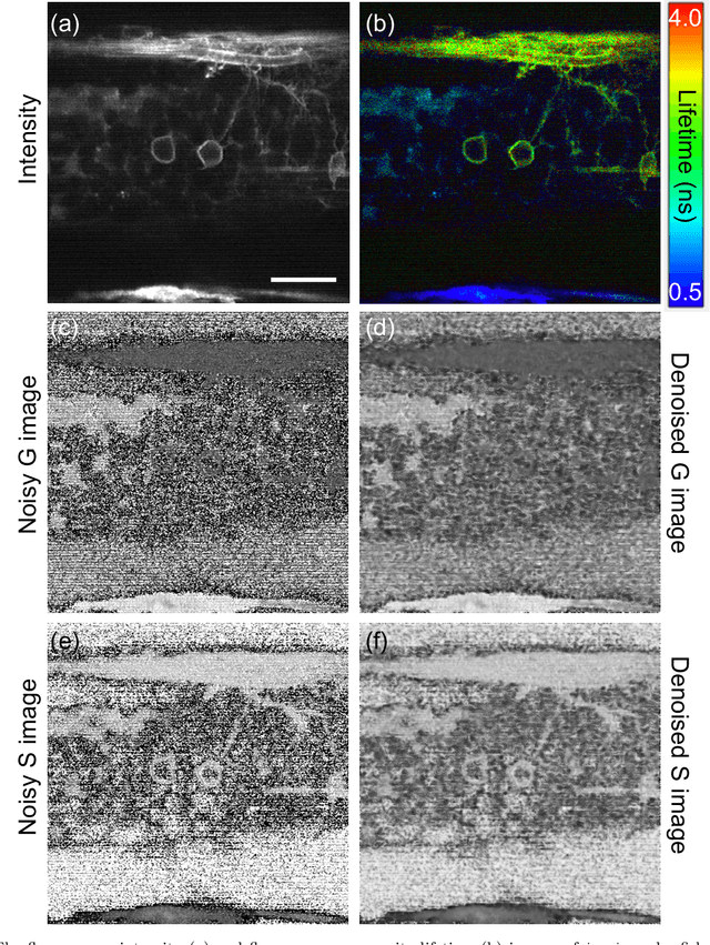 Figure 3 for Convolutional Neural Network Denoising in Fluorescence Lifetime Imaging Microscopy (FLIM)