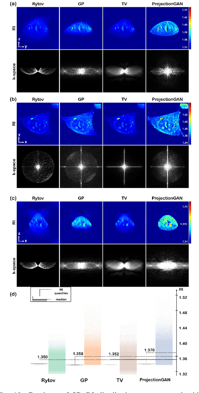 Figure 2 for Unsupervised Missing Cone Deep Learning in Optical Diffraction Tomography