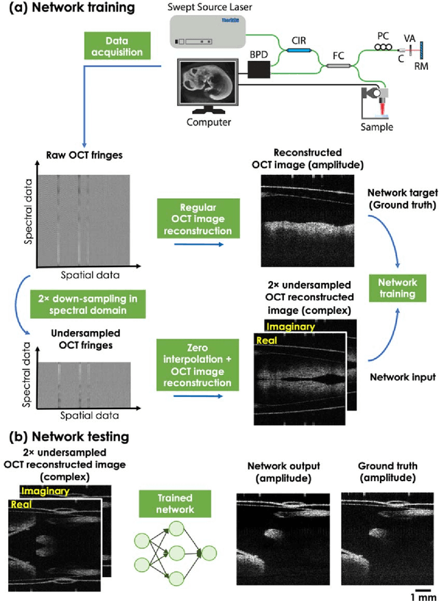 Figure 1 for Neural network-based image reconstruction in swept-source optical coherence tomography using undersampled spectral data