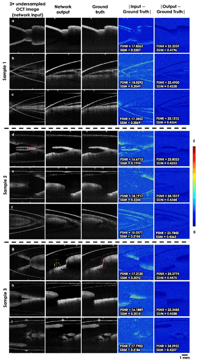 Figure 2 for Neural network-based image reconstruction in swept-source optical coherence tomography using undersampled spectral data