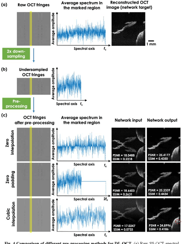Figure 4 for Neural network-based image reconstruction in swept-source optical coherence tomography using undersampled spectral data