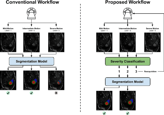 Figure 1 for Detecting respiratory motion artefacts for cardiovascular MRIs to ensure high-quality segmentation
