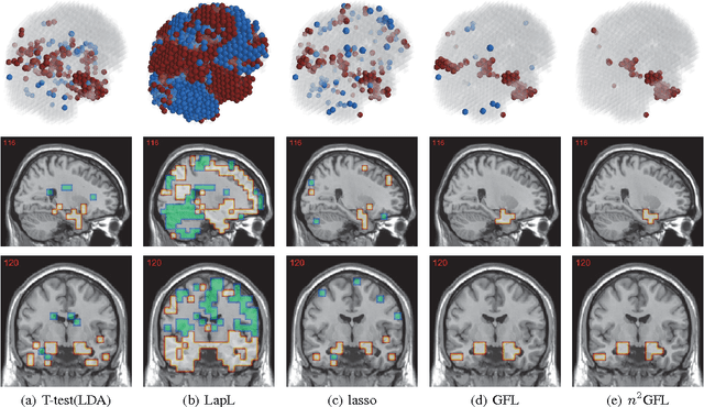 Figure 3 for Stable Feature Selection from Brain sMRI