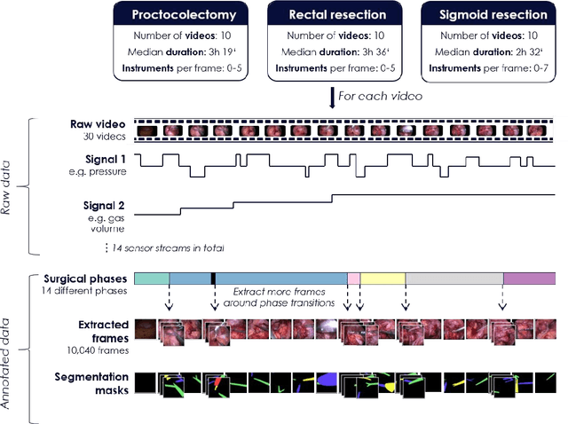 Figure 1 for Heidelberg Colorectal Data Set for Surgical Data Science in the Sensor Operating Room