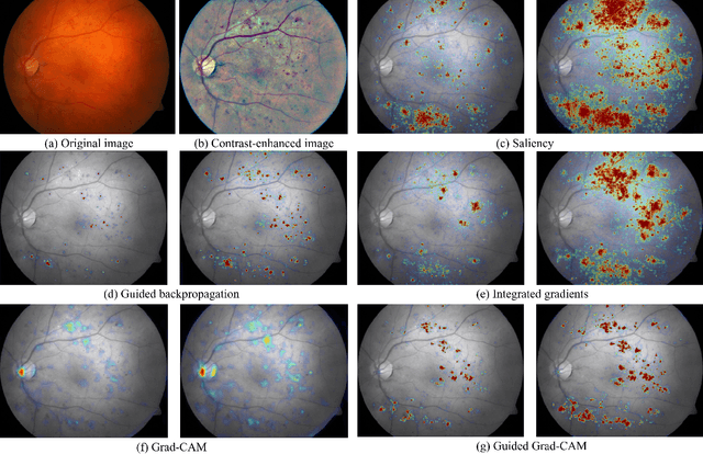 Figure 2 for Iterative augmentation of visual evidence for weakly-supervised lesion localization in deep interpretability frameworks