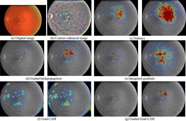 Figure 4 for Iterative augmentation of visual evidence for weakly-supervised lesion localization in deep interpretability frameworks