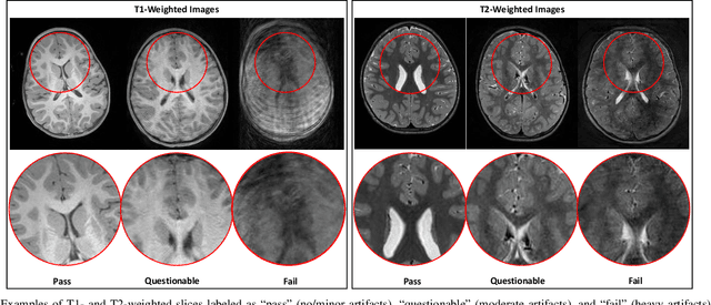 Figure 4 for Real-Time Quality Assessment of Pediatric MRI via Semi-Supervised Deep Nonlocal Residual Neural Networks