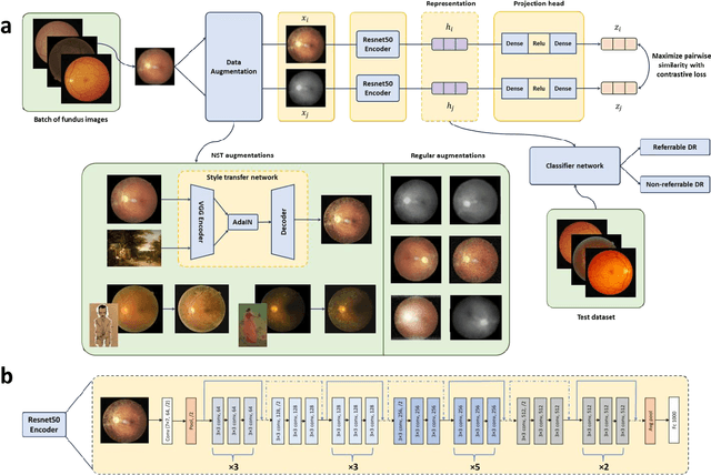 Figure 1 for Contrastive learning-based pretraining improves representation and transferability of diabetic retinopathy classification models