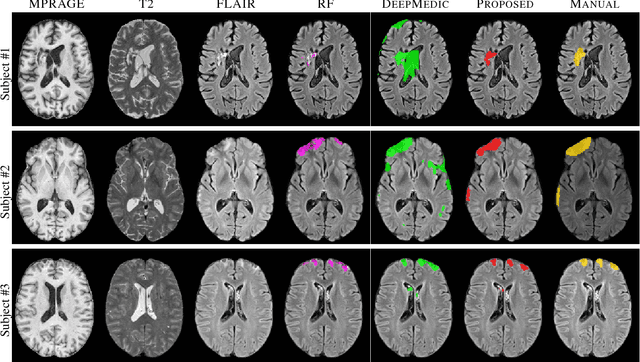 Figure 3 for TBI Contusion Segmentation from MRI using Convolutional Neural Networks