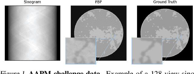 Figure 1 for Near-Exact Recovery for Tomographic Inverse Problems via Deep Learning