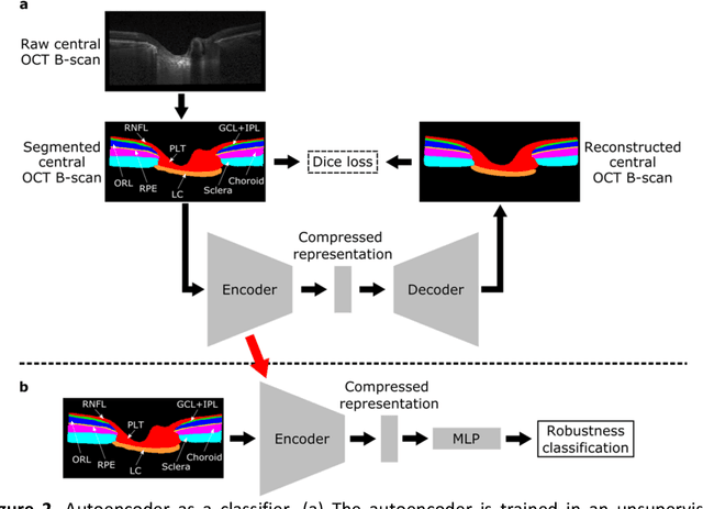Figure 3 for AI-based Clinical Assessment of Optic Nerve Head Robustness Superseding Biomechanical Testing