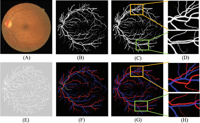 Figure 3 for Multi-Task Neural Networks with Spatial Activation for Retinal Vessel Segmentation and Artery/Vein Classification