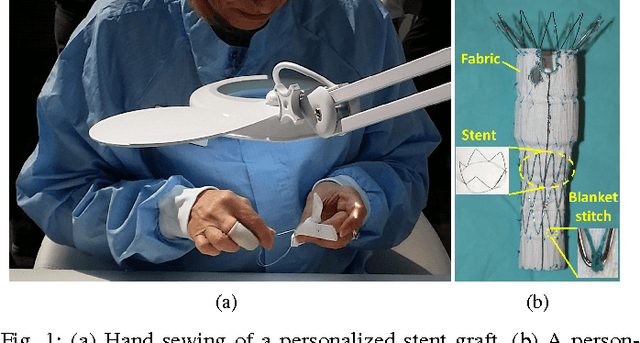 Figure 1 for A Multi-Robot Cooperation Framework for Sewing Personalized Stent Grafts