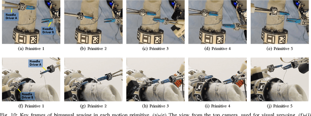 Figure 2 for A Multi-Robot Cooperation Framework for Sewing Personalized Stent Grafts