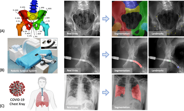 Figure 3 for SyntheX: Scaling Up Learning-based X-ray Image Analysis Through In Silico Experiments