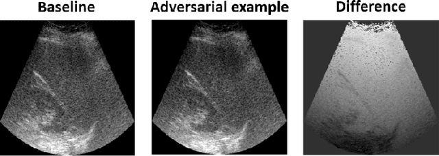 Figure 3 for Adversarial attacks on deep learning models for fatty liver disease classification by modification of ultrasound image reconstruction method