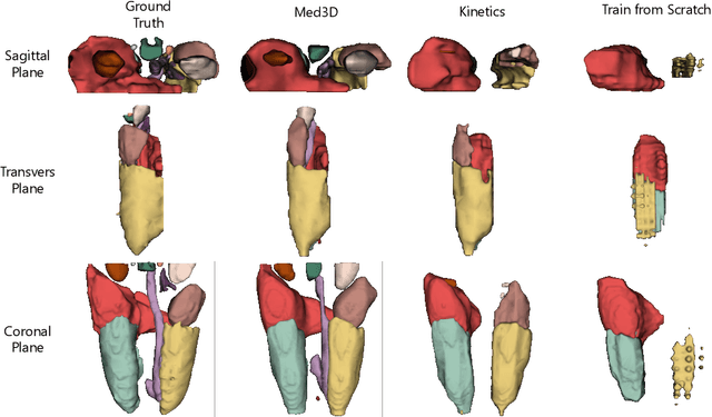 Figure 1 for Med3D: Transfer Learning for 3D Medical Image Analysis