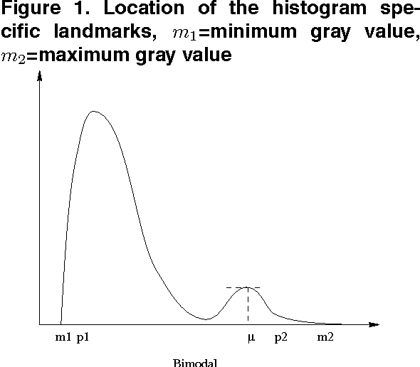 Figure 1 for Multiresolution Elastic Medical Image Registration in Standard Intensity Scale