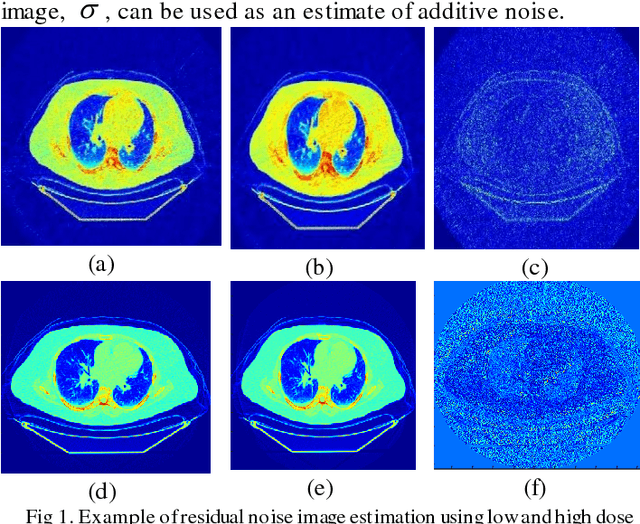 Figure 1 for Blind Analysis of CT Image Noise Using Residual Denoised Images