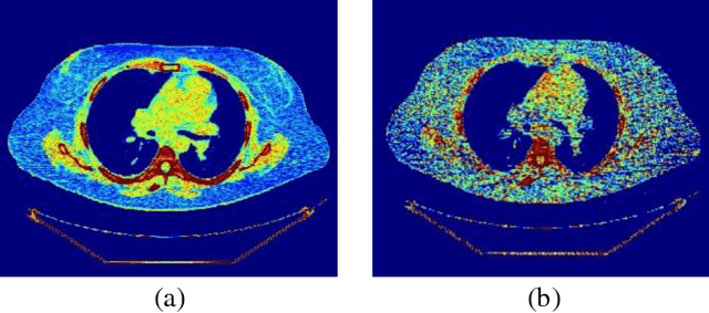 Figure 3 for Blind Analysis of CT Image Noise Using Residual Denoised Images