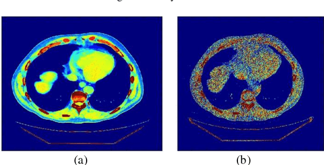 Figure 4 for Blind Analysis of CT Image Noise Using Residual Denoised Images