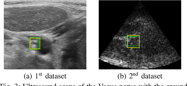 Figure 3 for A CNN Segmentation-Based Approach to Object Detection and Tracking in Ultrasound Scans with Application to the Vagus Nerve Detection