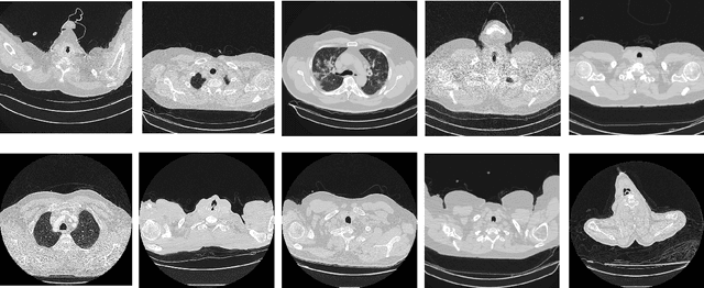 Figure 1 for TeliNet: Classifying CT scan images for COVID-19 diagnosis