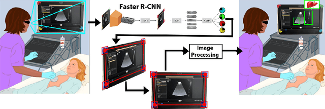 Figure 1 for Screen Tracking for Clinical Translation of Live Ultrasound Image Analysis Methods