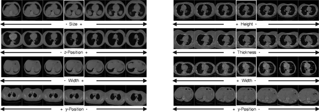 Figure 3 for Interpreting Latent Spaces of Generative Models for Medical Images using Unsupervised Methods