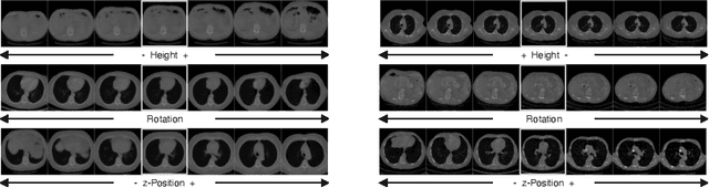 Figure 4 for Interpreting Latent Spaces of Generative Models for Medical Images using Unsupervised Methods