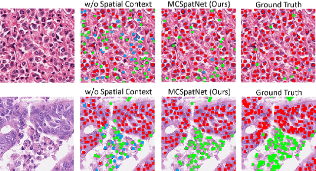 Figure 1 for Multi-Class Cell Detection Using Spatial Context Representation