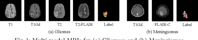 Figure 1 for NestedFormer: Nested Modality-Aware Transformer for Brain Tumor Segmentation