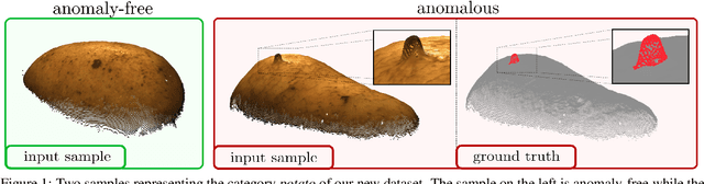 Figure 1 for The MVTec 3D-AD Dataset for Unsupervised 3D Anomaly Detection and Localization