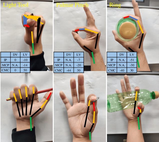 Figure 2 for Towards Complex and Continuous Manipulation: A Gesture Based Anthropomorphic Robotic Hand Design