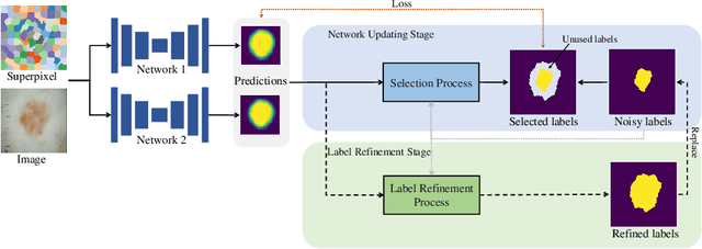 Figure 1 for Superpixel-guided Iterative Learning from Noisy Labels for Medical Image Segmentation