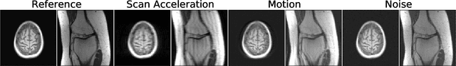 Figure 1 for Image Quality Assessment for Magnetic Resonance Imaging