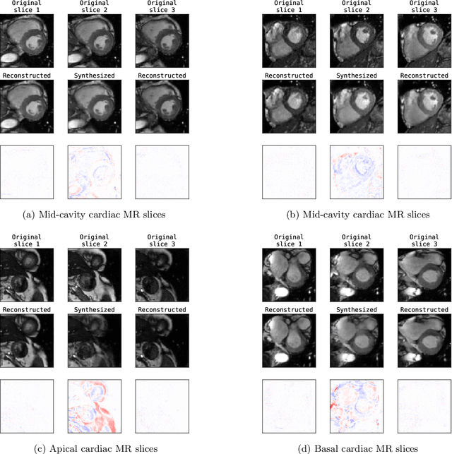 Figure 2 for Unsupervised Super-Resolution: Creating High-Resolution Medical Images from Low-Resolution Anisotropic Examples