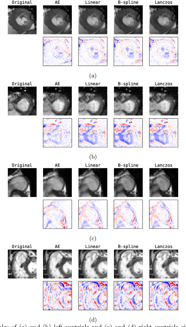 Figure 4 for Unsupervised Super-Resolution: Creating High-Resolution Medical Images from Low-Resolution Anisotropic Examples