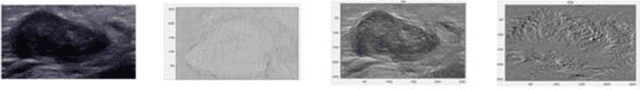 Figure 2 for Knowledge AI: New Medical AI Solution for Medical image Diagnosis