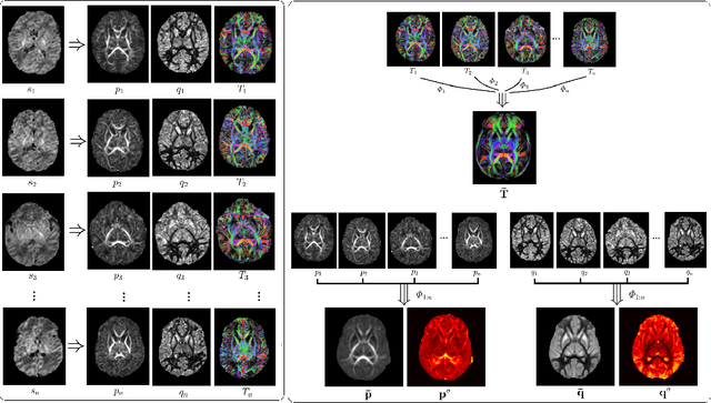 Figure 1 for Atlas-powered deep learning (ADL) -- application to diffusion weighted MRI