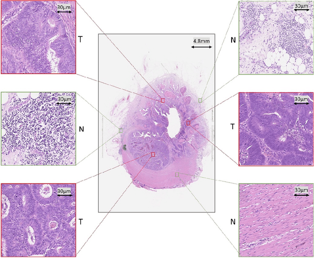 Figure 1 for Fast and Accurate Tumor Segmentation of Histology Images using Persistent Homology and Deep Convolutional Features