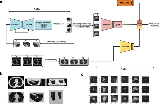 Figure 2 for Enhancing Cancer Prediction in Challenging Screen-Detected Incident Lung Nodules Using Time-Series Deep Learning