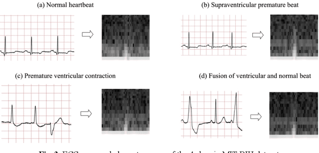 Figure 4 for ECG Heartbeat classification using deep transfer learning with Convolutional Neural Network and STFT technique