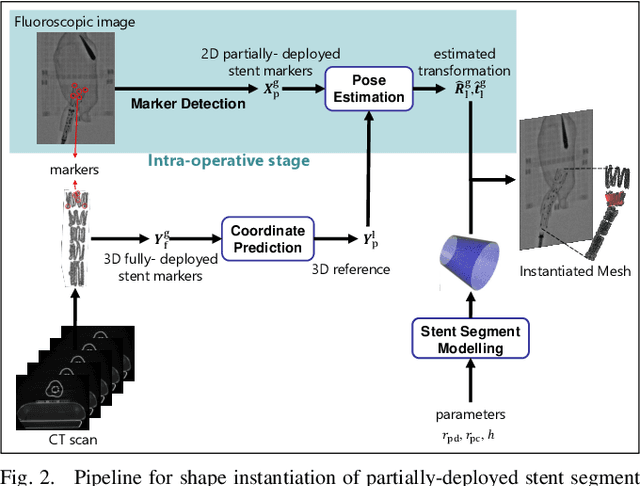 Figure 3 for Real-time 3D Shape Instantiation for Partially-deployed Stent Segment from a Single 2D Fluoroscopic Image in Robot-assisted Fenestrated Endovascular Aortic Repair