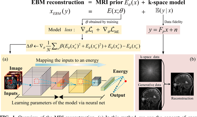 Figure 1 for MRI Reconstruction Using Deep Energy-Based Model