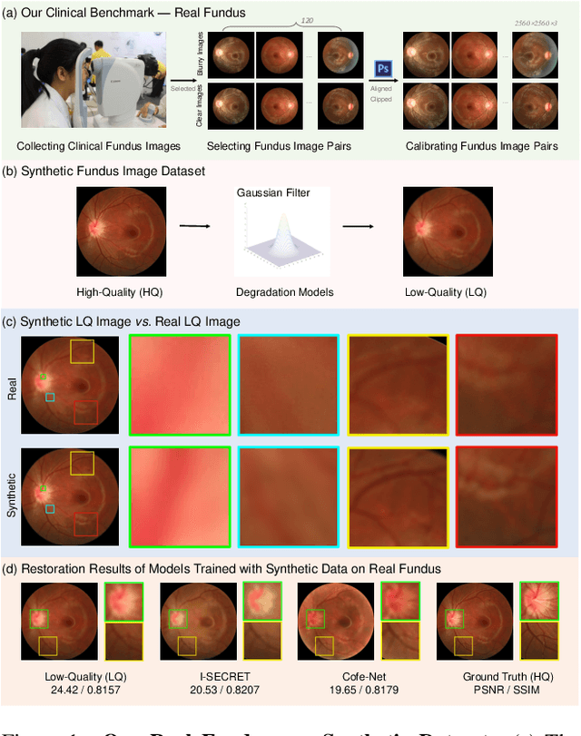 Figure 1 for RFormer: Transformer-based Generative Adversarial Network for Real Fundus Image Restoration on A New Clinical Benchmark